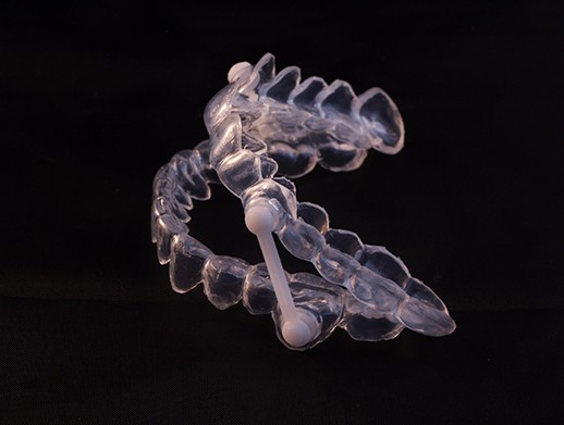 Model of an oral appliance for sleep apnea.