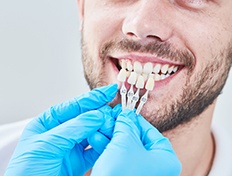 Nose-to-neck view of man smiling with blue-gloved hands holding shade-guide to his teeth