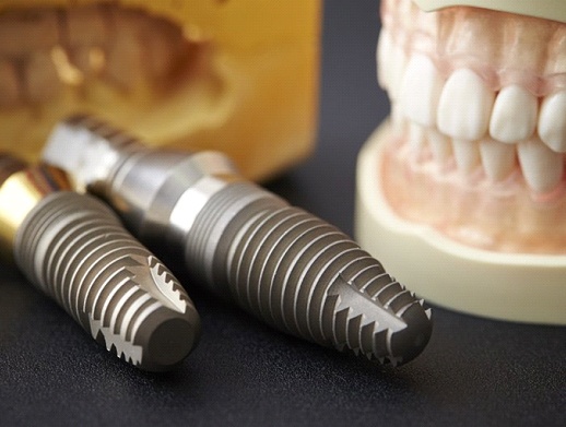 dental implants lying on a table next to a set of dentures