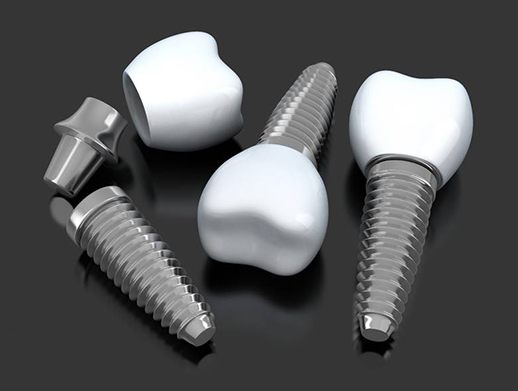 three dental implants in Skokie with abutments and crowns