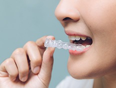 Closeup of patient putting on clear aligner