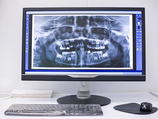 digital x-ray on computer