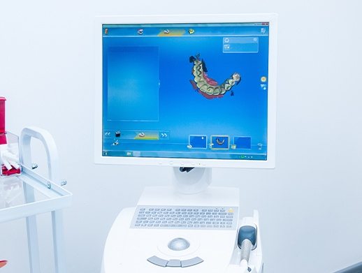 CEREC computer impression system