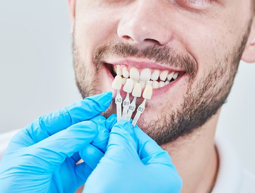 man getting fitted for veneers in Skokie