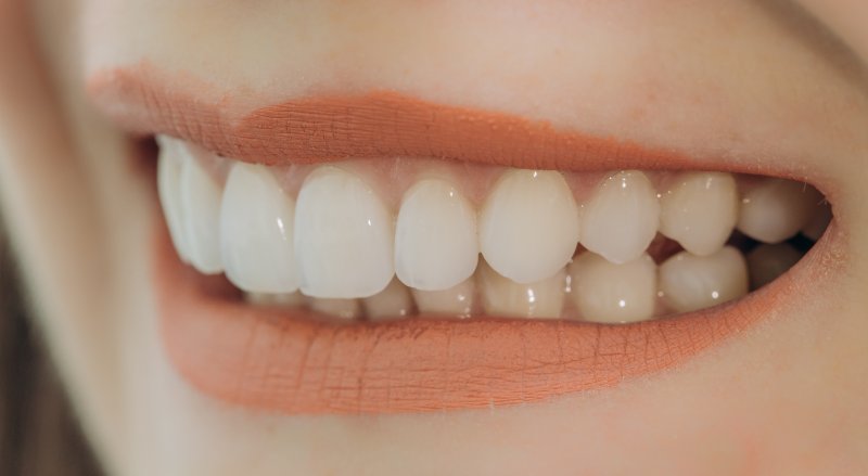 Woman with veneers in Skokie