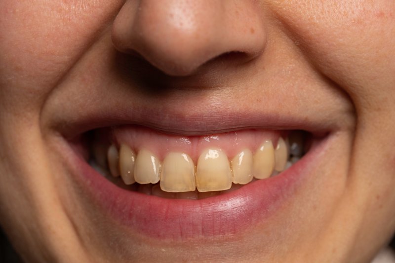 Close-up of person with yellow teeth